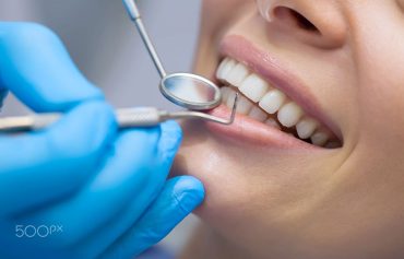 Fillings & Root Canal Treatment